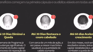 Vídeo Infoproduto | Hair Loss Blocker